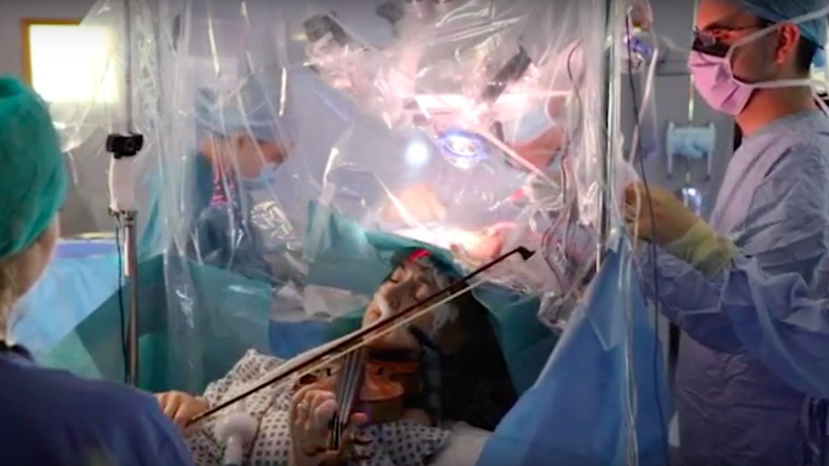 Pacientka v Británii během operace mozku hrála na housle